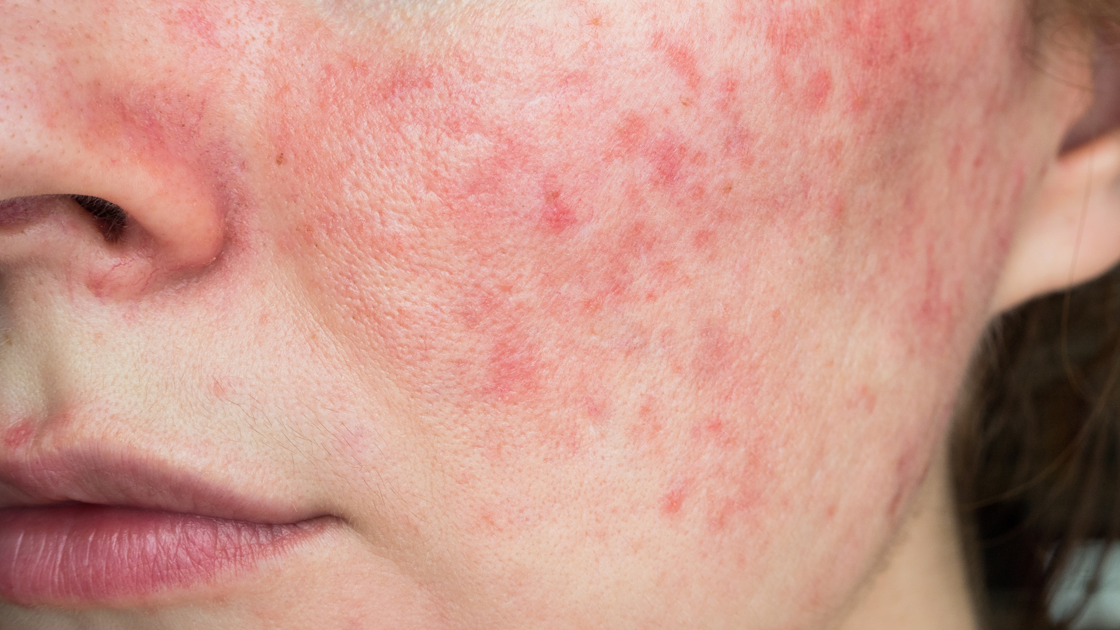 Block Inner Skin Exploring the Skin Barrier: Gaining Insights from Aesthetic and Skinca
